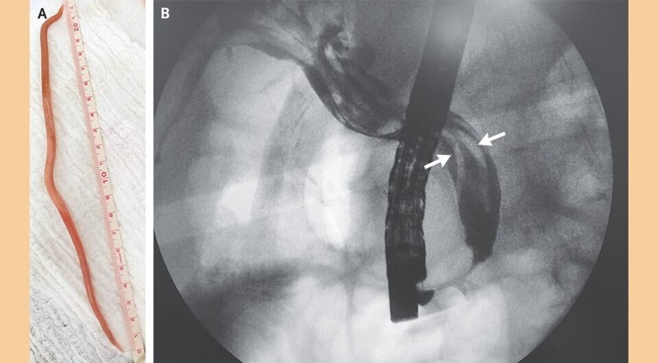   Juan J. Chaves et al. / The New England Journal of Medicine, 2023