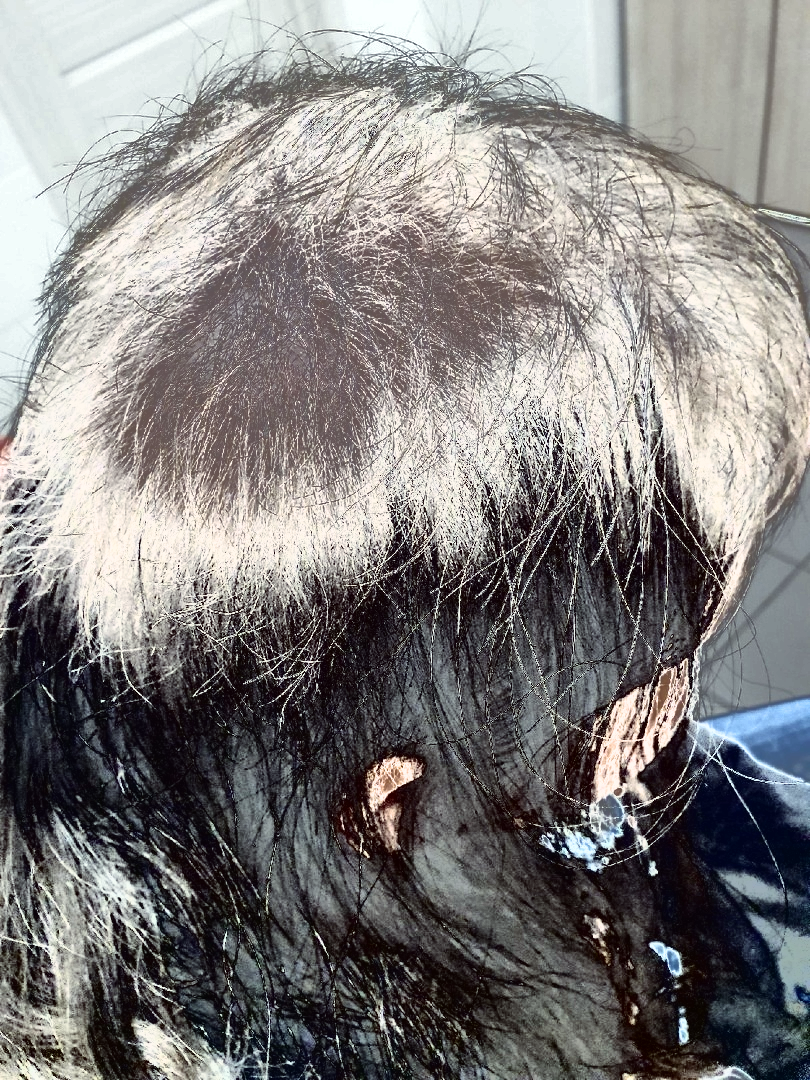 Её пытались лечить неправильно