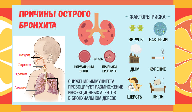 Бронхит (обструктивный, острый)