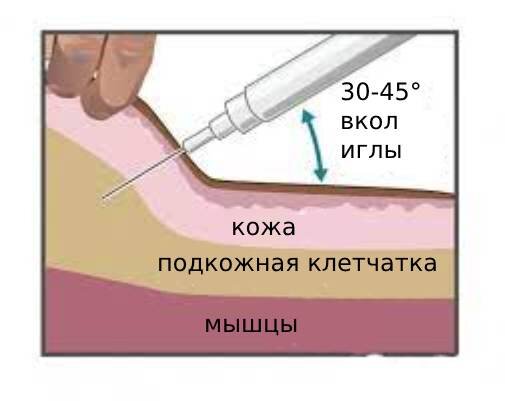 Укол собаке: куда и как сделать