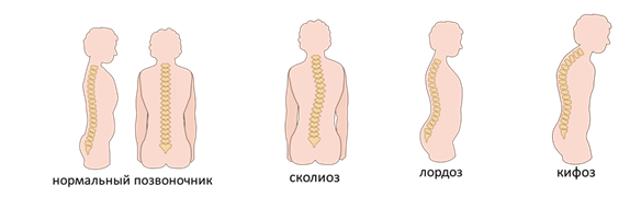 Пена в моче при белке. Ровная спина. Желтый цвет мочи. Как выглядит нормальная. Нормальный цвет мочи.