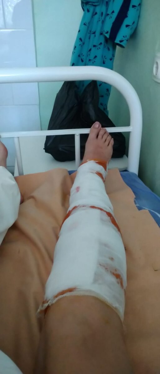 Прям после снятия. Еще даже от наркоза не успела отойти.