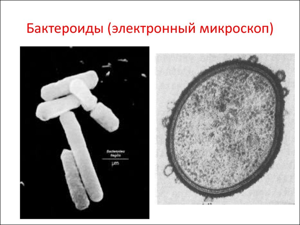 Гр палочки. Бактероиды фрагилис. Бактероиды микроскопия. Бактероиды в электронном микроскопе. Патогенез бактероиды микробиология.