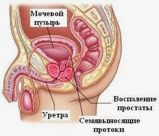 Нормальная и плохая спермограмма, показатели норма, Киев
