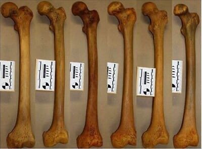 Бедренные кости разных людей. 
