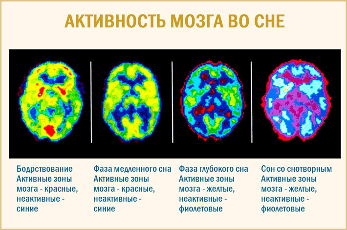 Почему во время сна наш мозг работает лучше? | Obichnyi_Kanal | Дзен