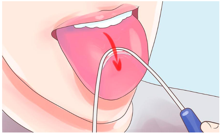 Правильная чистка языка скребком