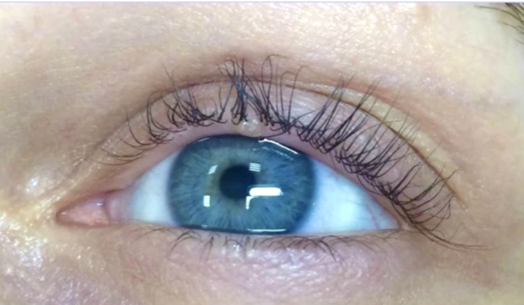 Это фото уже через месяц, перед наращиванием