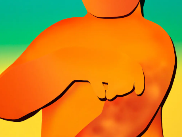 Сыпь не проходила, и зуд разрушал ее жизнь.