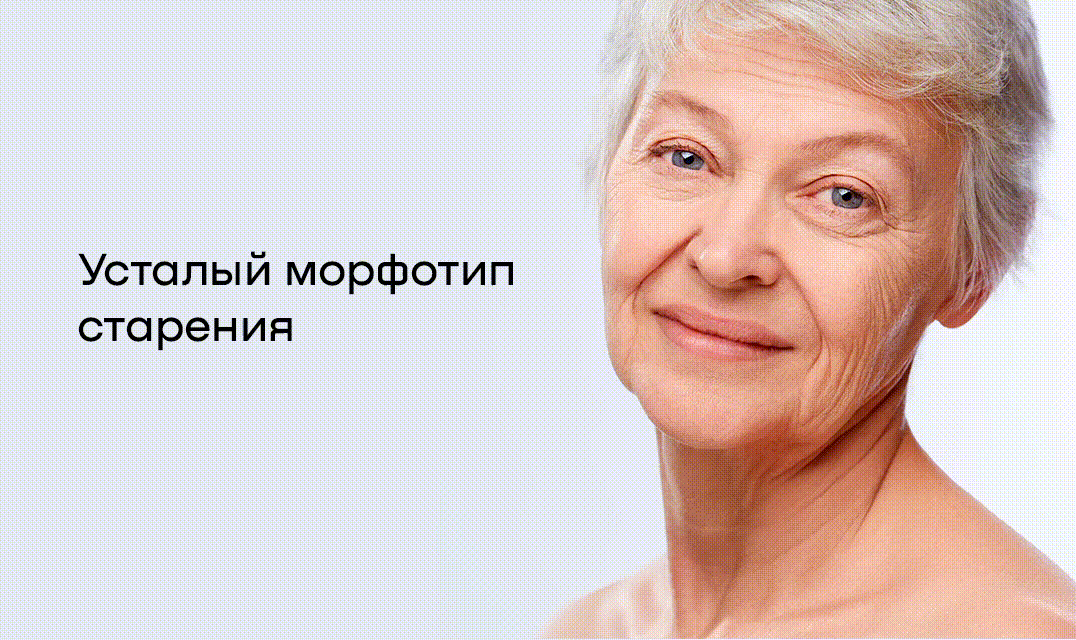 А какой тип старения актуален для вас?