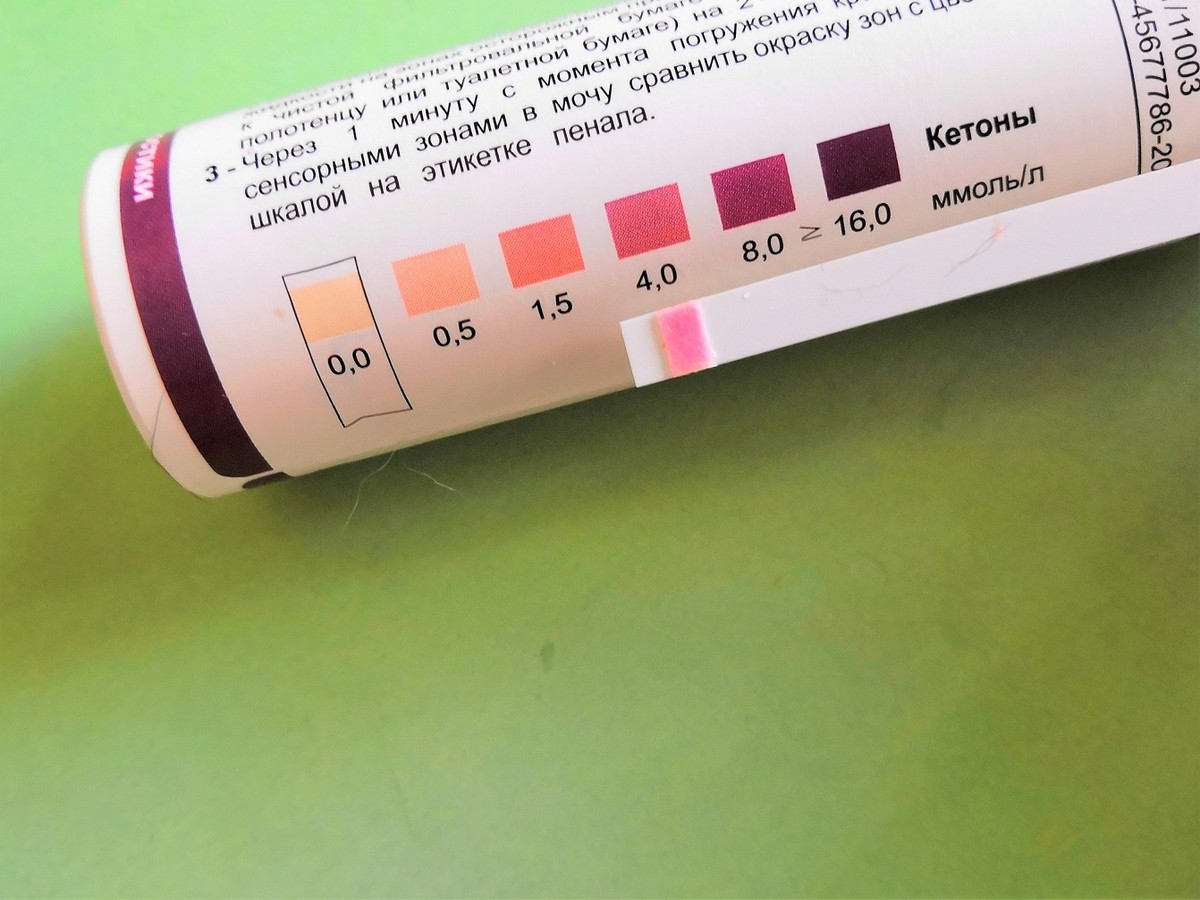 Запах при кето. Кетоглюк-1 тест-полоски на ацетон. Полоски Кетоглюк. Тест полоски на ацетон в моче. Тест полоски на кетоны в моче.
