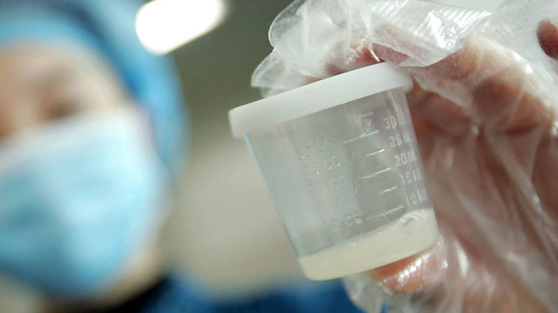 Подготовка к спермограмме: как правильно сдать сперму | «Новая лаборатория»