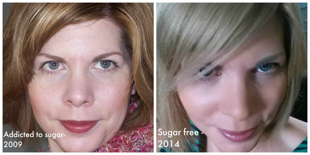 Сравните внешний вид лица после отказа от сахара.