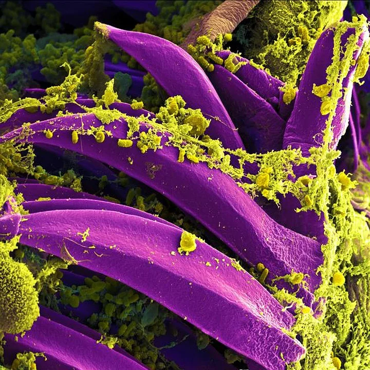 https://pixabay.com/photos/bacteria-electron-microscope-808154/
