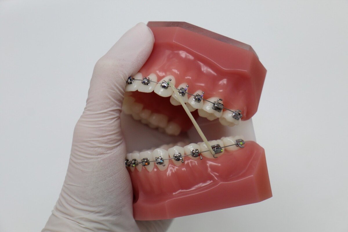 Эластик (резиночка)