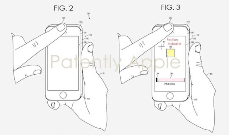 Диагностика мерцательной аритмии — привилегия не только Apple Watch