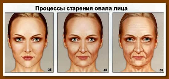 Подтяжка овала лица до и после Boulder Bliss Medical Spa Nefertiti Lift Consult