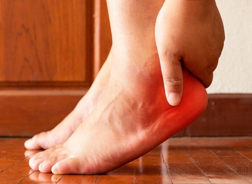 Больная пятка.