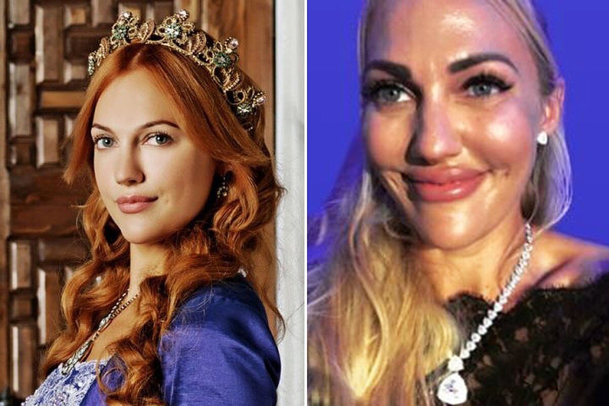 операции, которые сделала Мерьем Узерли