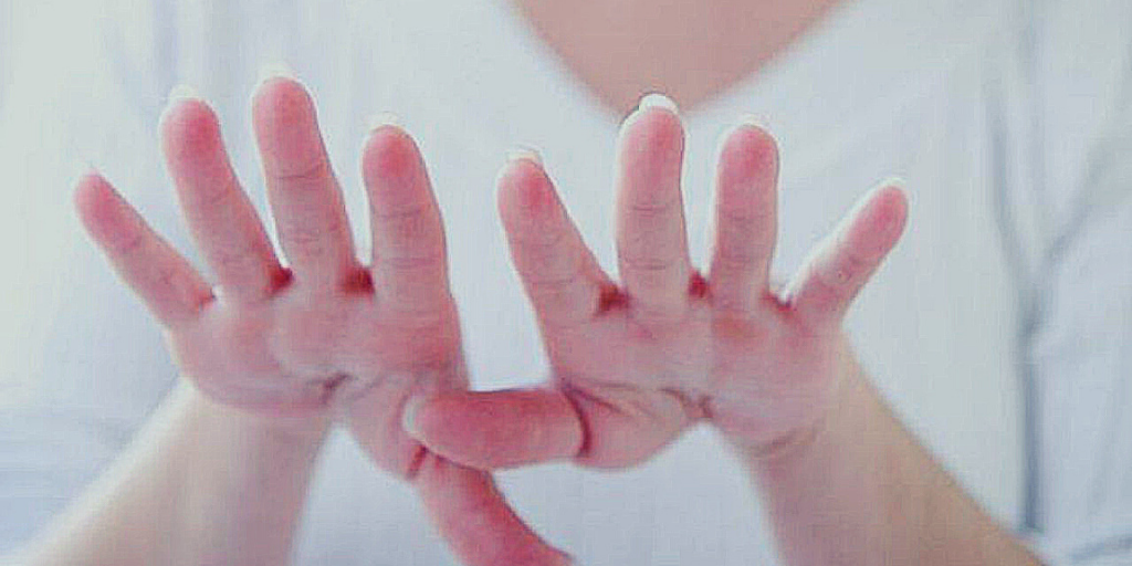 Тремор рук.