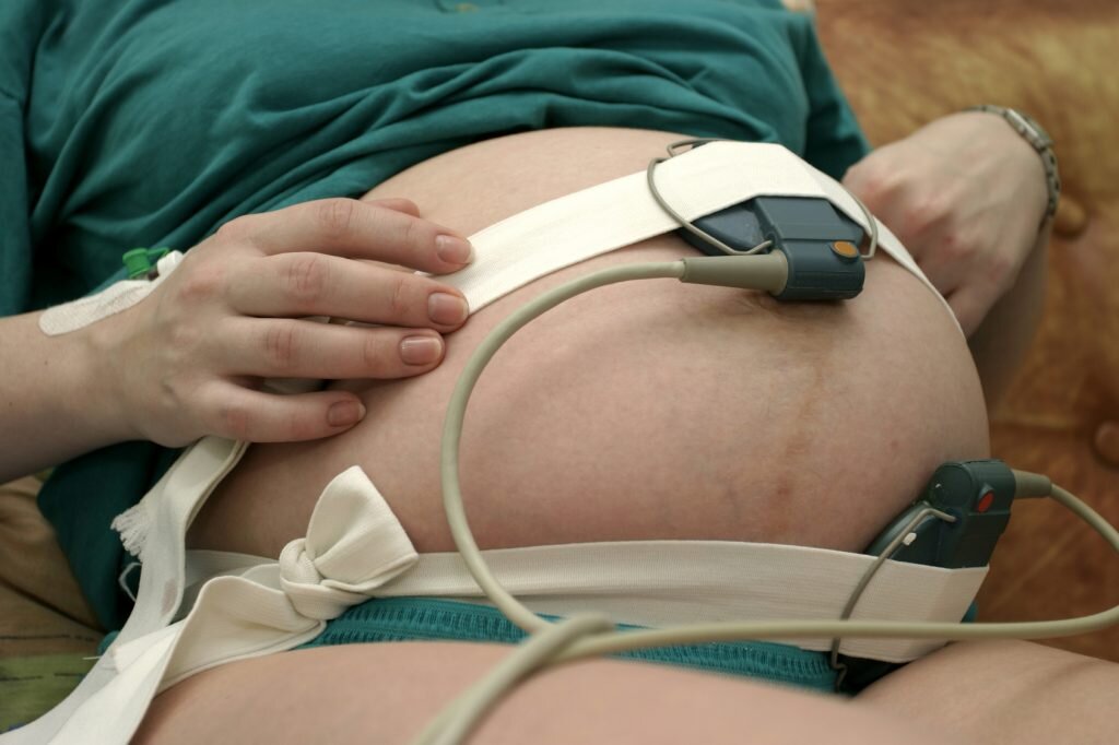 Схватки тест. КТГ. КТГ беременности. Аппарат КТГ. Кардиотокография при беременности.