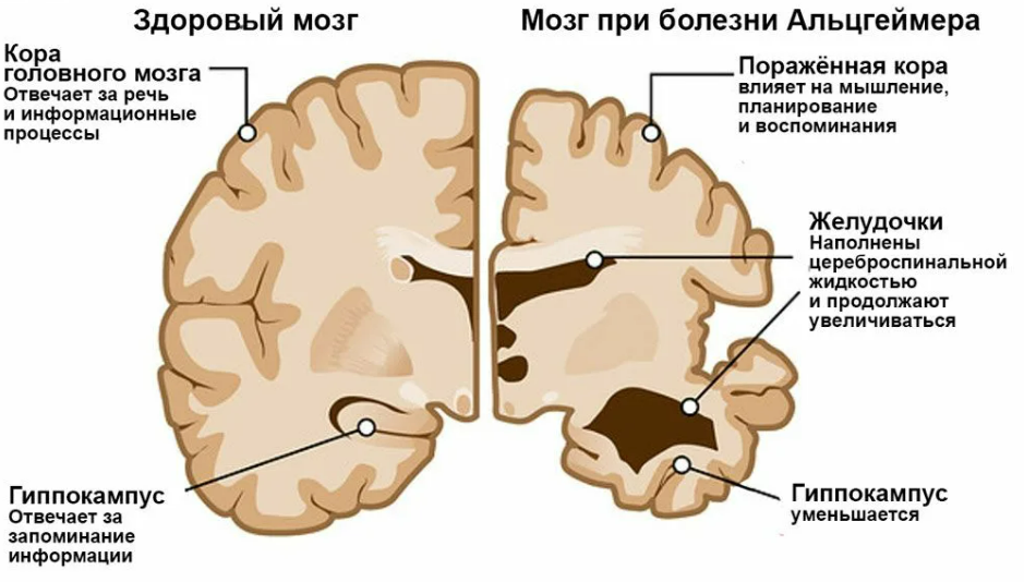 Фотография взята из источника docfact.ru