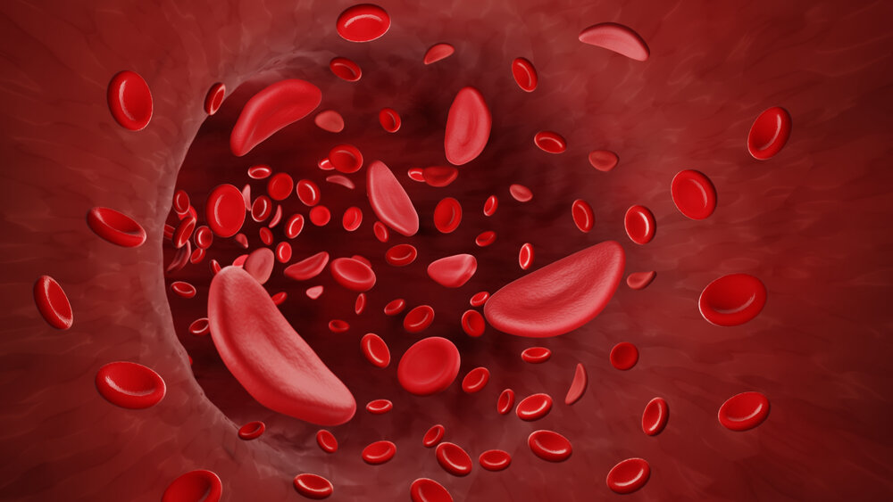 Низкий гемоглобин — симптомы и причины | Smart Medical Center