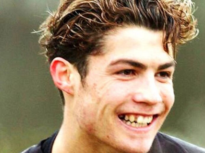 До пластики