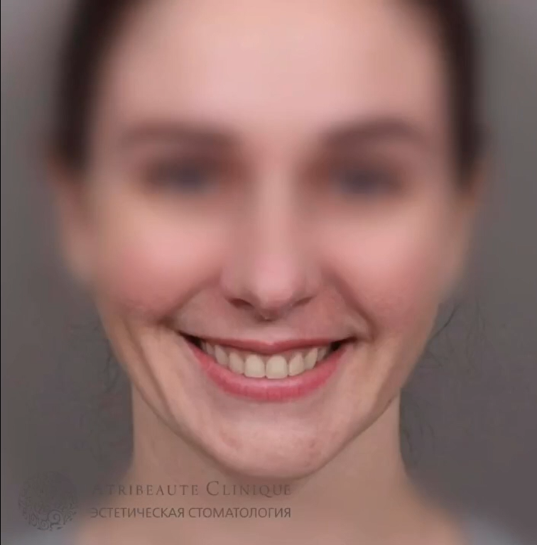 Фото "После" 