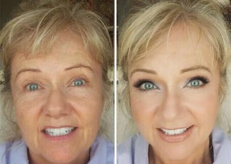 Омоложение. Морщины. Женщины. Полезный совет. Красота.