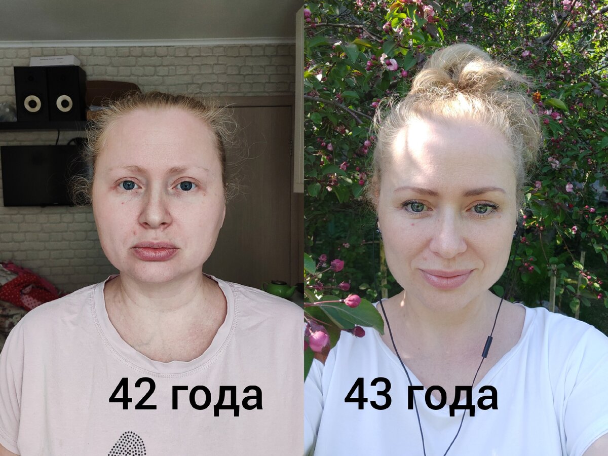 Анастасия адоньева фото до и после