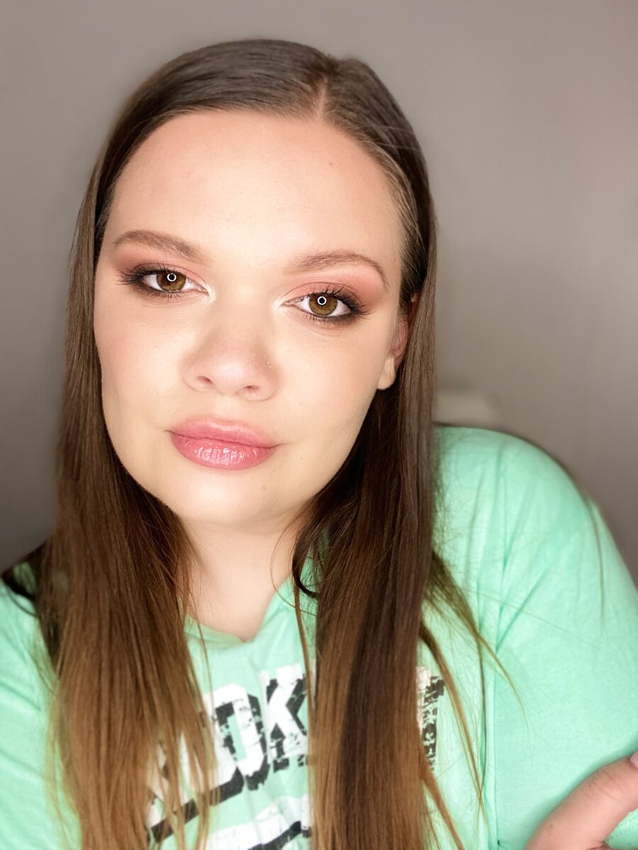 Фото сделанное за 2 дня до пробы сыворотки. Из ретуши: только цветокоррекция. 