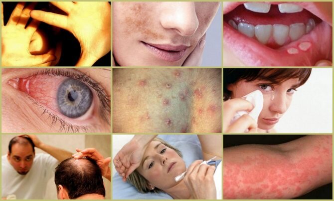 побочные эффекты обезболивающих препаратов