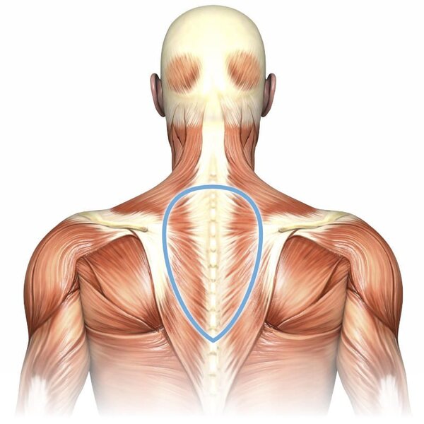 Жировые отложения в области седьмого шейного позвонка