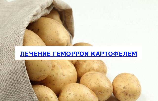 Лечение геморроя народными средствами