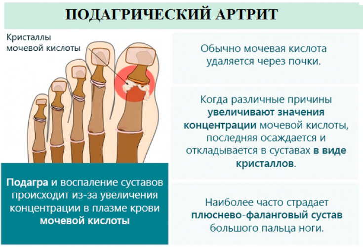 диета при заболеваниях суставов ног | Дзен