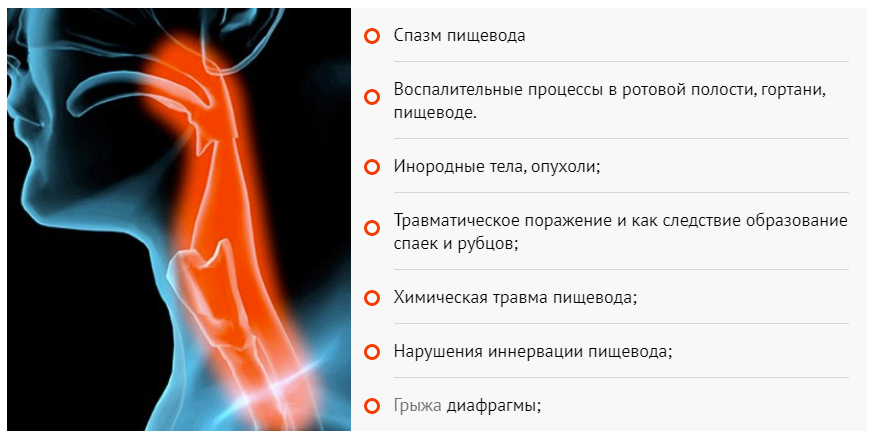 Почему пульсирует шея. Боль при глотании слева. Боль при глотании в области шеи. Боль при глотании в пищеводе.