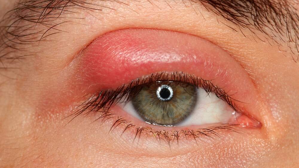 ВОТ ТАКИЕ НЕСЧАСТНЫЕ БЫЛИ ГЛАЗКИ... ФОТО  ИЗ ИНТЕРНЕТА.