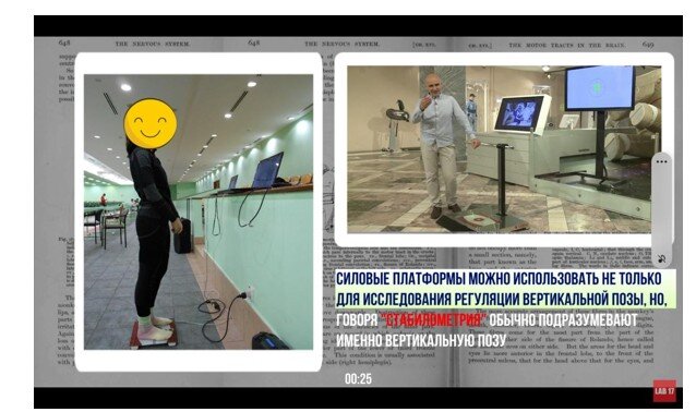 Рисунок. 11. Скриншот из блиц-лекции «Стабилометрия и исследование вертикальной позы»