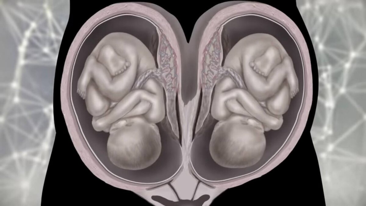 Пример аномальной беременности. Источник Яндекс Картинки.