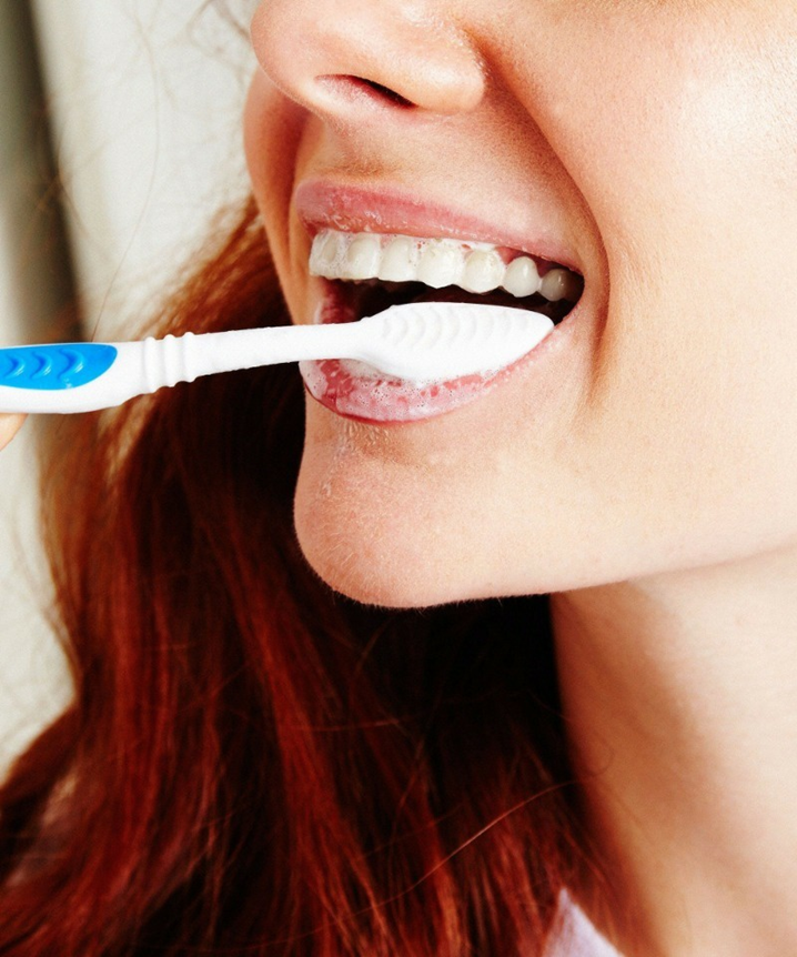 Чистим зубы!. Плохая гигиена полости рта. Красивая улыбка с зубной щеткой. Девушка чистит зубы.