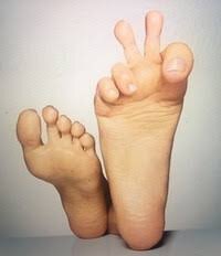 Онихомикоз нужно лечит обязательно, как  и любые другие заболевания!