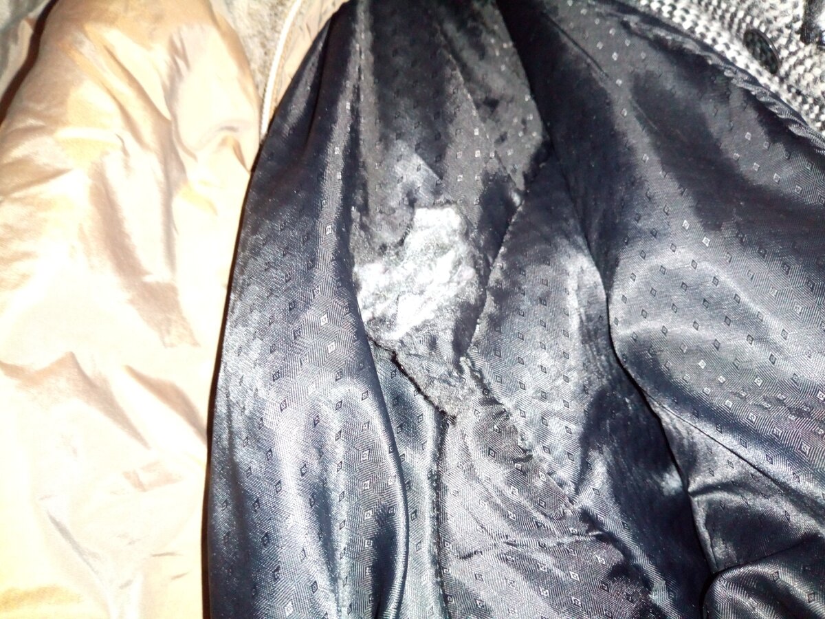 и в районе проймы( под мышкой )