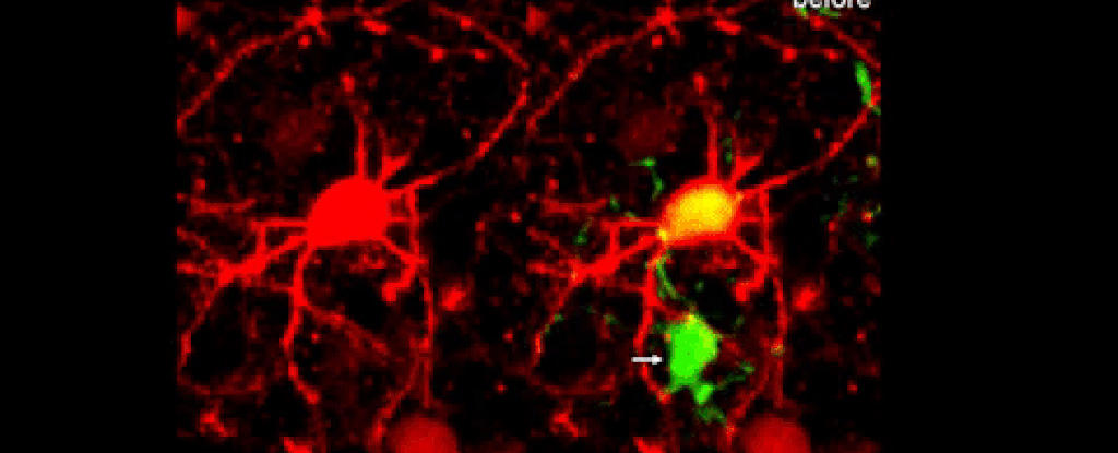 Клетки мозга восстанавливаются. Нейроны головного мозга. Нейроны gif. Клетка gif. Регенерация клеток.