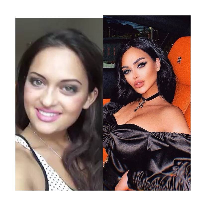 Какие операции делала Нита Кузьмина: фото до и после,