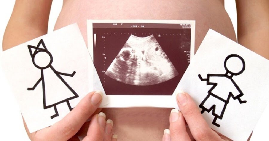 http://www.cyxymu.info/2017/11/selektivnie-aborti-Georgia.html