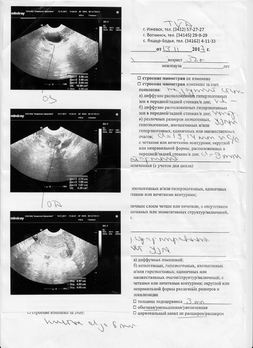Узи малыша первого ребенка