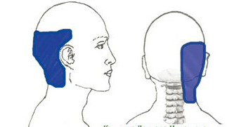 Почему болит затылок и что с этим делать? | Блог о здоровье