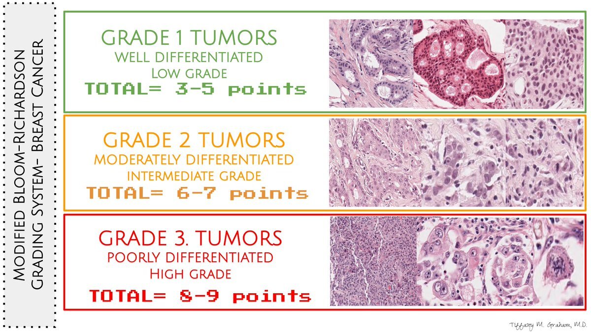 stages-grades