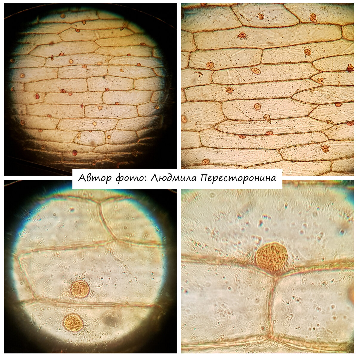 Клетки кожицы под микроскопом